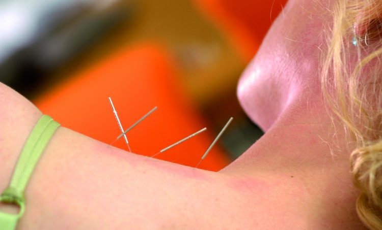         Acupunctuur en moxatherapie